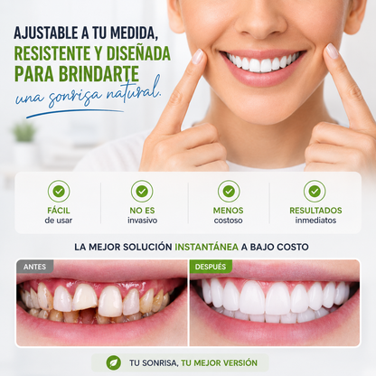 SNAP SMILE™ CARILLAS DENTALES REMOVIBLES